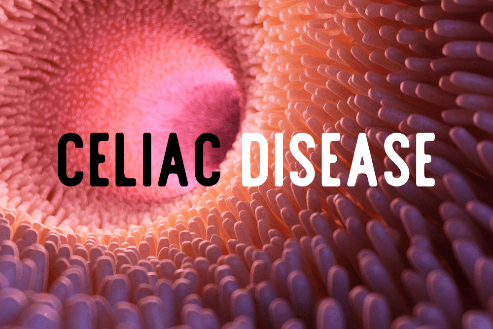 Celiac Disease